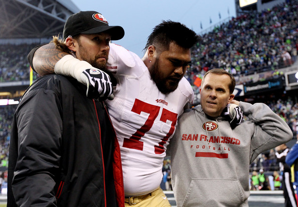 49ers: Mike Iupati diagnosed with broken left fibula